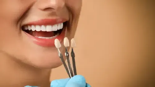 What is the Cost of Dental Veneers?
